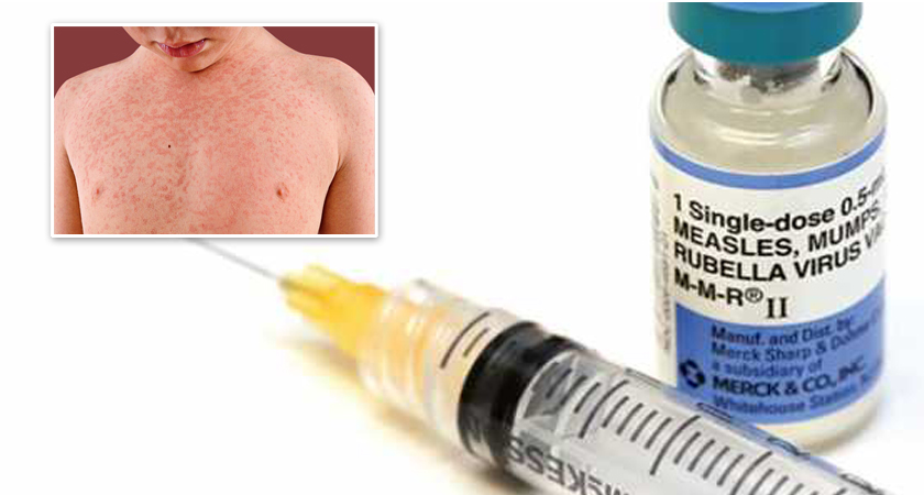 खोपको प्रयोग नगर्दा दादुराले प्रकोपको रुप लिँदै